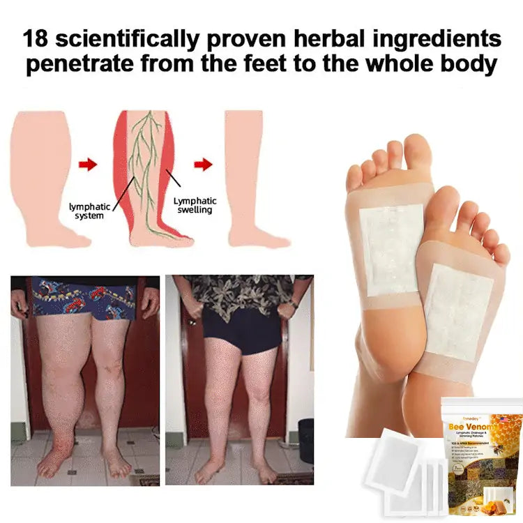 BeeVora™ Bee Venom Lymphatic Drainage & Slimming Foot Patches 🌿👣