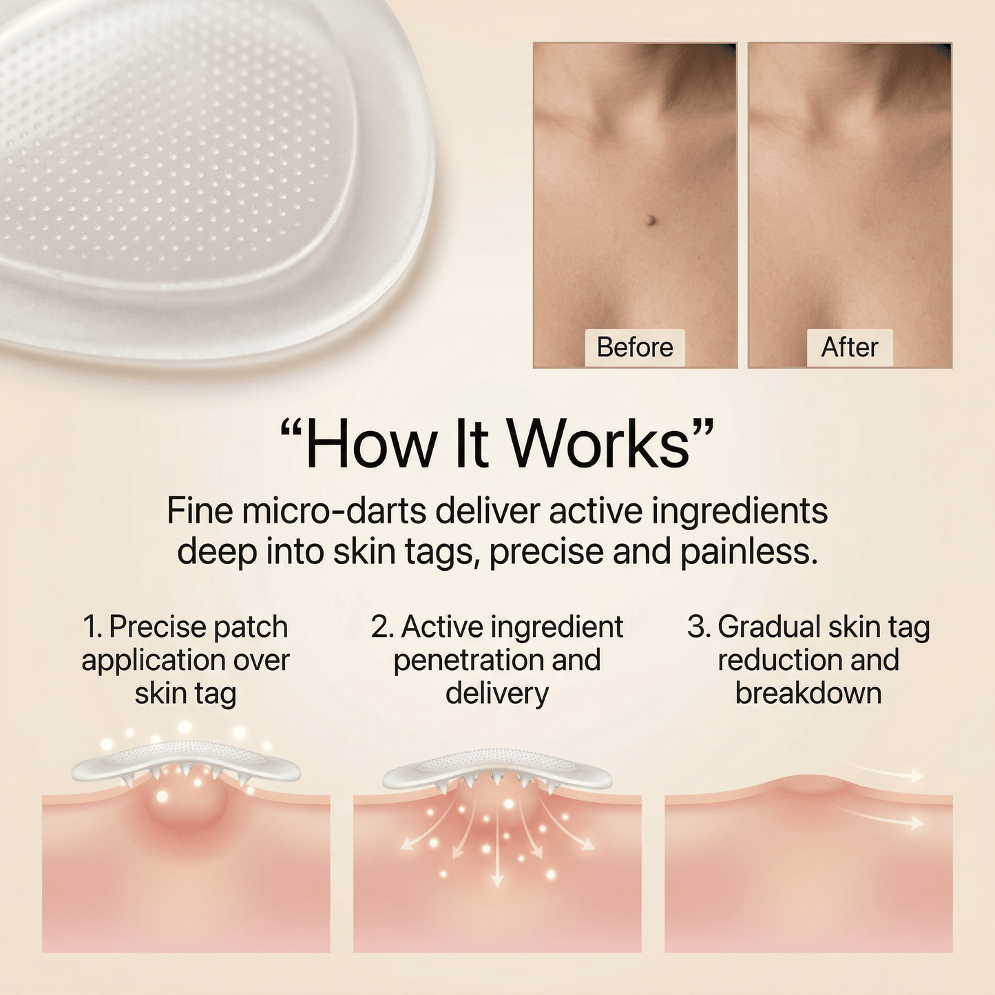 DermaSmooth - Tag & Mole Remover